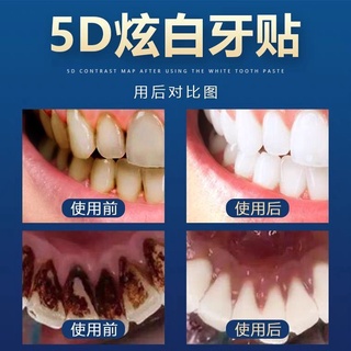 [Hàng mới về] Miếng dán làm trắng răng tiện lợi