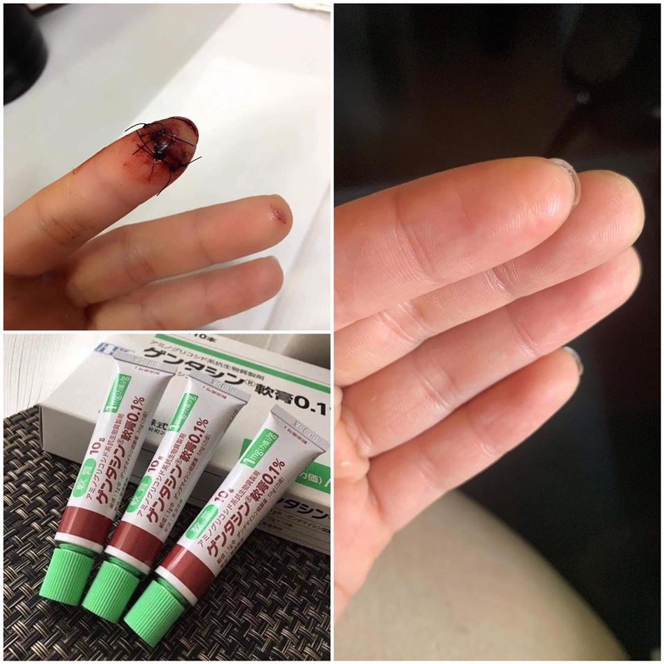 [Mã 2611TIEUDUNG100K giảm 8% đơn 500K] GEL XÓA SẸO GENTACIN OINTMENT 0,1% GENTAMICIN SULFATE - 1 tuýp | BigBuy360 - bigbuy360.vn