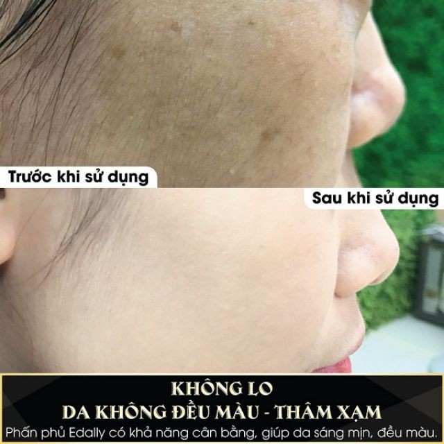 PHẤN PHỦ DƯỠNG ẨM, KIỀM DẦU EDALLY