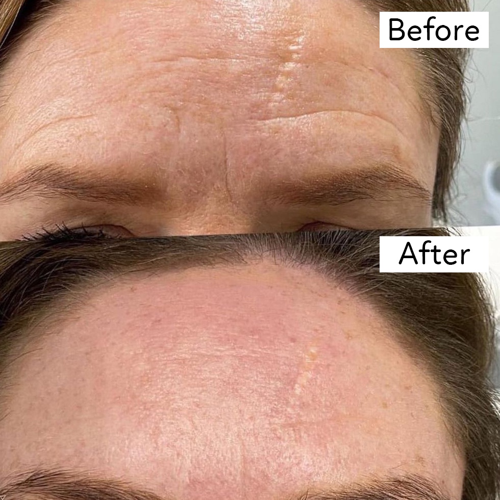 Tinh Chất Cấp Ẩm, Sáng Da, Ngăn Lão Hóa Cosrx The Retinol 0.5 Oil, Niacinamide 15, Vitamin C 23, Hyaluronic Acid 3 Serum