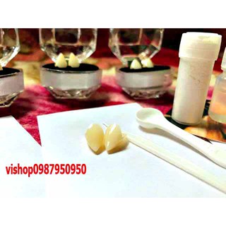 Răng khểnh đẹp