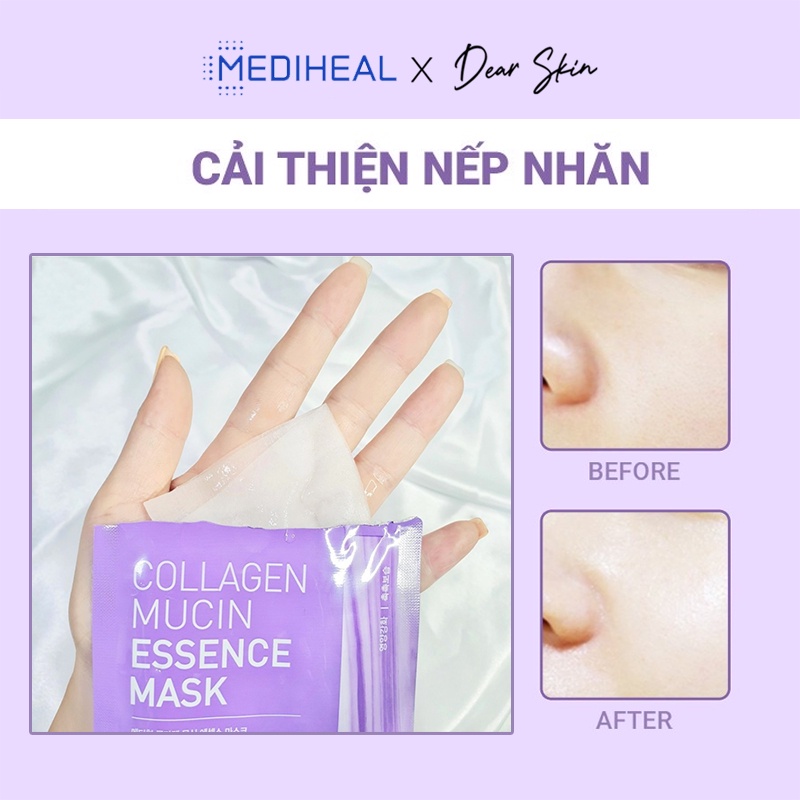 [Chính hãng] Mặt nạ Mediheal dưỡng da căng mịn, mọng nước, làm đều màu, sáng mịn da, ngăn ngừa các nếp nhăn và lão hóa