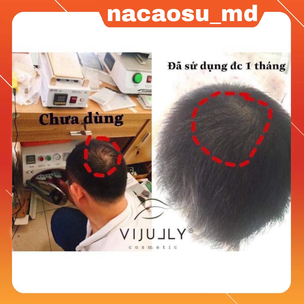 Tinh Dầu Bưởi Vi Jully không vỏ 100% Thiên Nhiên KÍCH MỌC TÓC-TRỊ RỤNG TÓC-GIÚP TÓC NHANH DÀI, DÀY