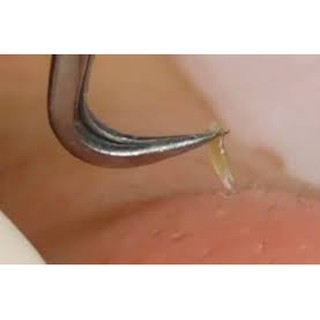 Nhíp Gắp Mụn Đầu Cong Chuẩn