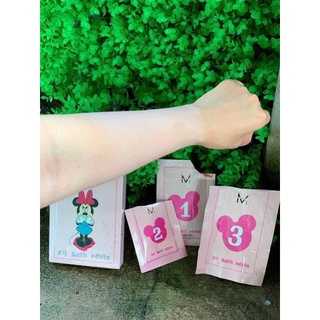 tắm trắng mickey