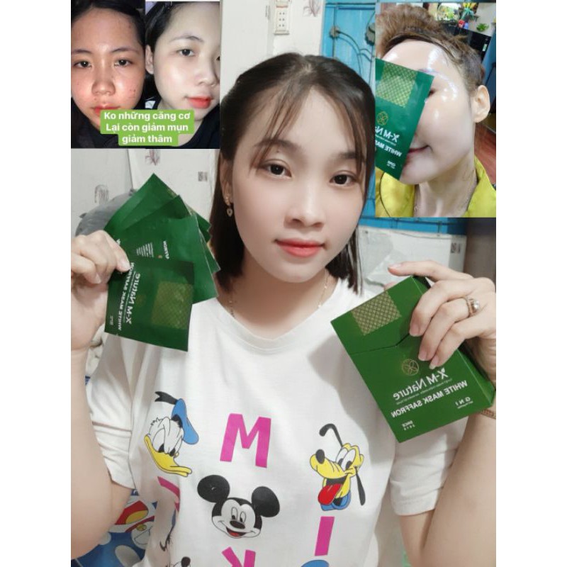 CẤY TRẮNG NÂNG CƠ CHÍNH HÃNG