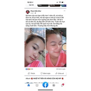 KEM DƯỠNG TRẮNG DA MẶT