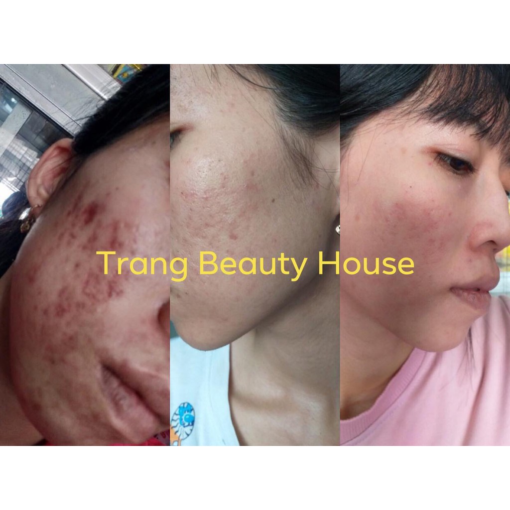 Thuốc Bắc Tái Tạo Da