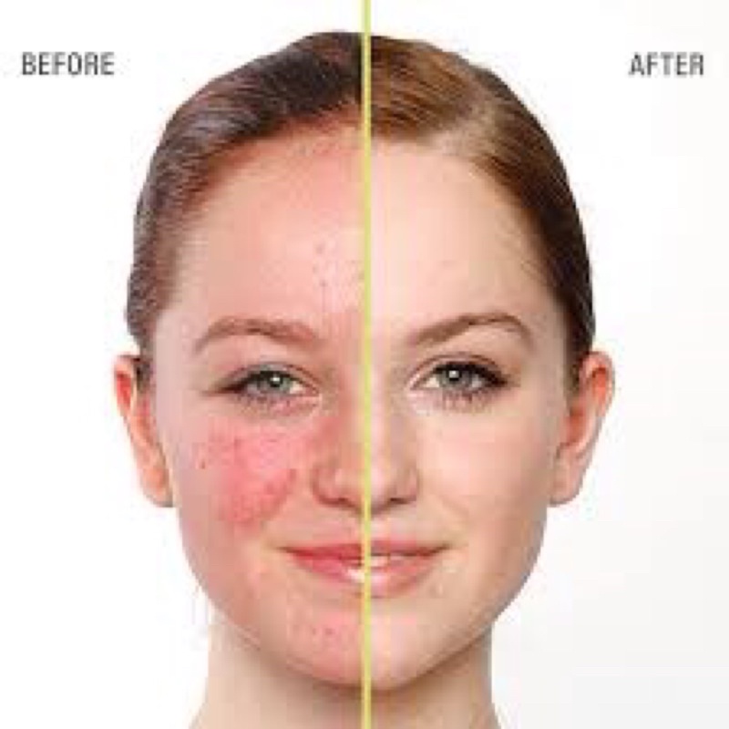 Kem dưỡng ẩm không dầu Juice Beauty OIL-FREE MOISTURIZER