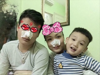 Miếng dán hút mụn Beone