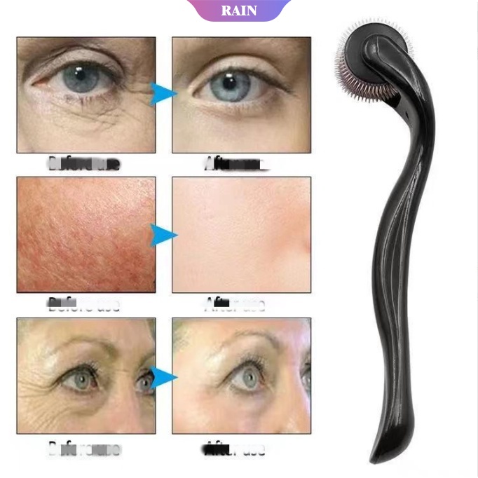 Cây Lăn Kim 540 Micro Chuyên Dụng Kích Thích Mọc Râu/Tóc 0.25/0.5mm