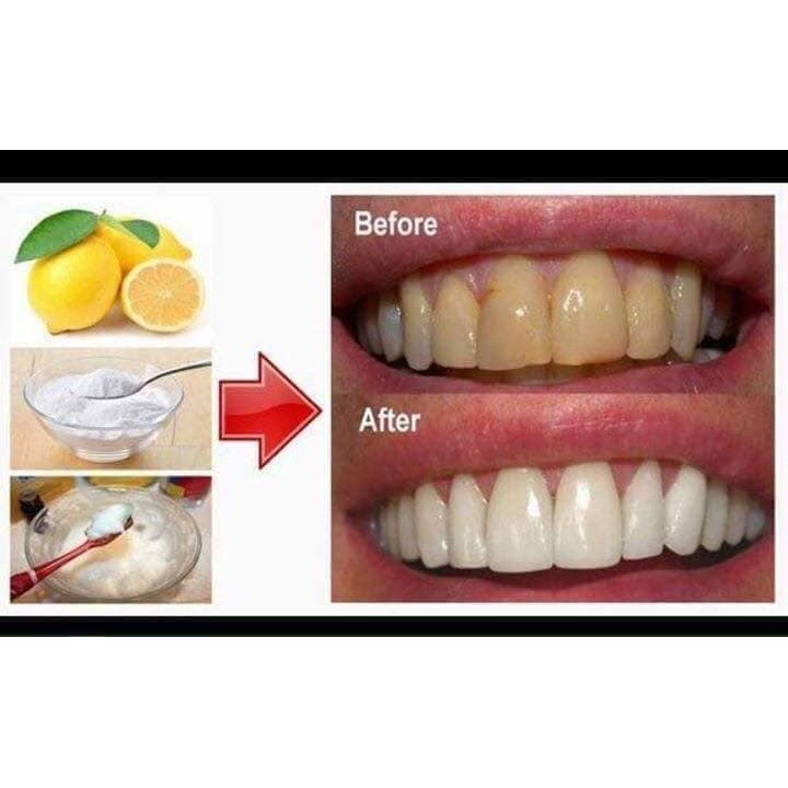 Hộp Bột Banking soda 454g | BigBuy360 - bigbuy360.vn