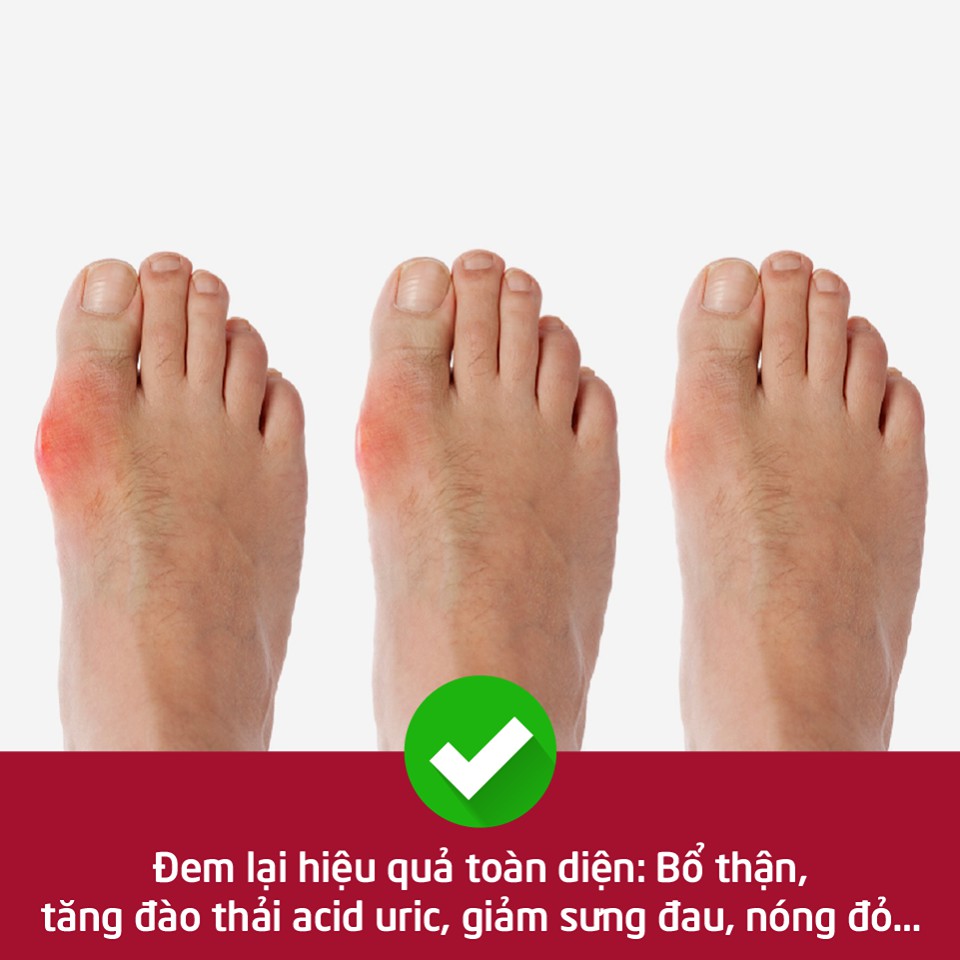 ✅  Hoàng Tiên Đan | Giảm triệu chứng bệnh gút, giảm acid uric, tăng cường chức năng gan thận
