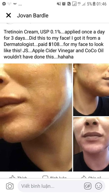 Tretinoin tretinol Ấn Độ gel ngăn ngừa và giảm mụn nám tàn nhang Usp A ret 0,025 0,05 0,1 % | BigBuy360 - bigbuy360.vn