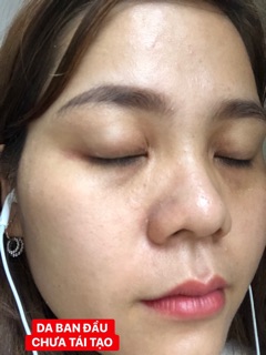 KEM TÁI TẠO CHAMOMILESKILL