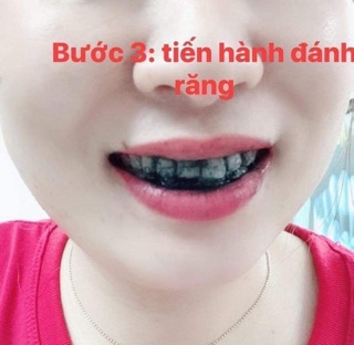 Than hoạt tính trắng răng My smile