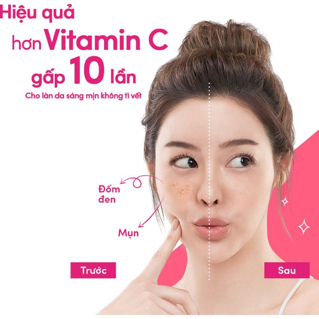 BỘ KEM DƯỠNG TRẮNG DA NGÀY & ĐÊM POND'S 50g