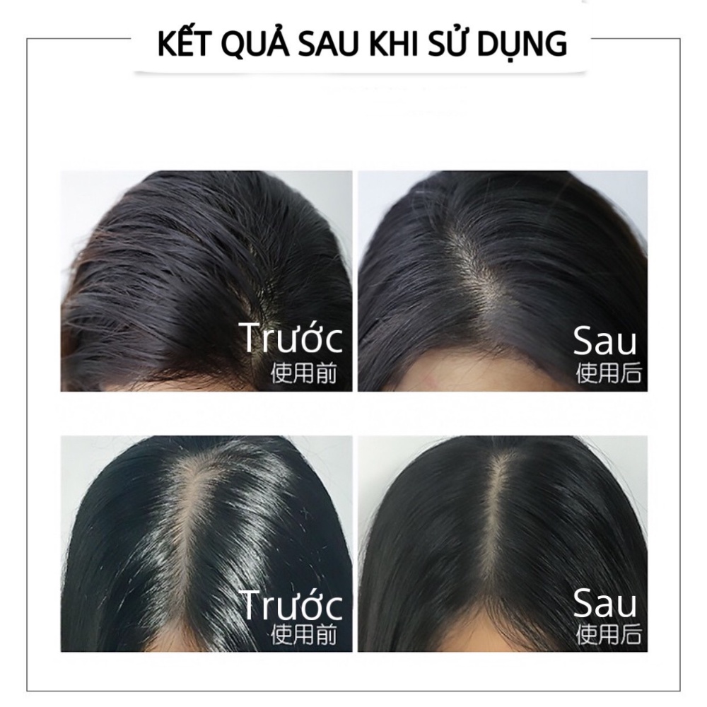 Dầu gội khô ISSY dạng xịt giúp tóc bồng bềnh mượt mà không gây bết dính hàng nội địa trung 150ml - BBC Cosmetic