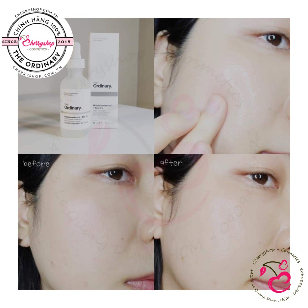 Tinh chất dưỡng The Ordinary