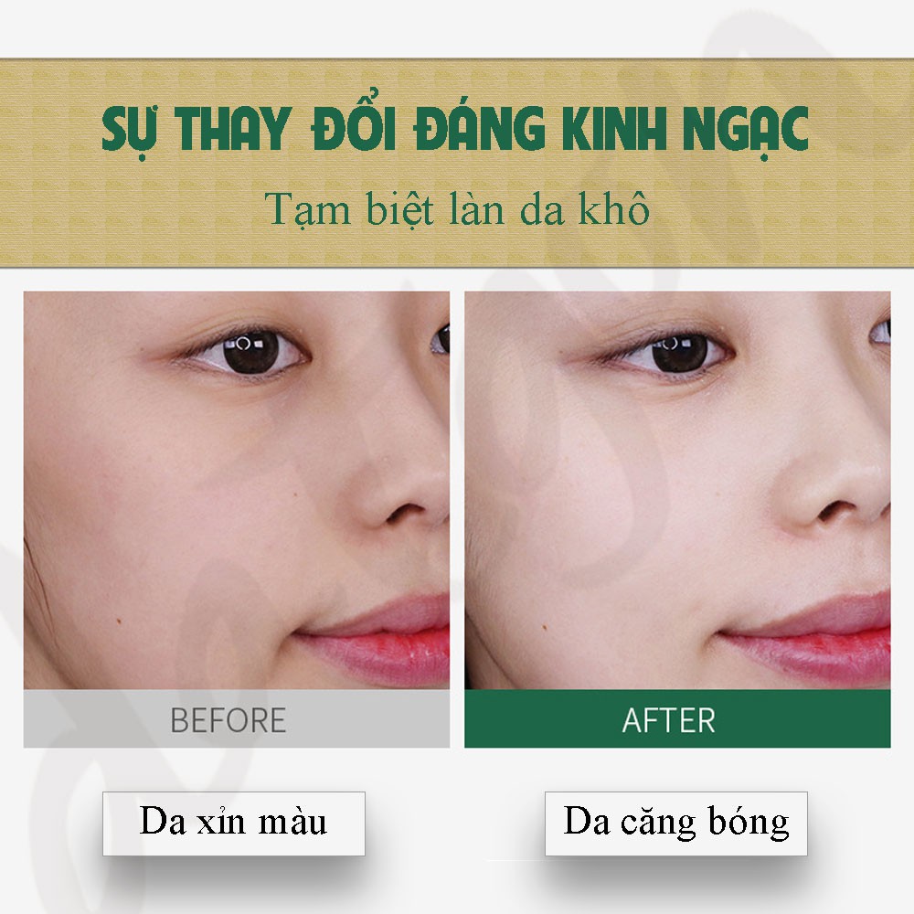 Mặt nạ dưỡng ẩm trắng da rau má, Mask Feotznw se khít lỗ chân lông chống lão hóa 30ml