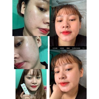 Serum Mộc Beauty