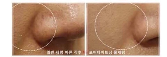 (TRẢ ORDER/ LIÊN HỆ TRC KHI ĐẶT) SERUM BRTC PORE TIGHTENING