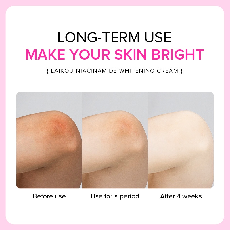 Kem dưỡng làm trắng vùng da dưới cánh tay Laikou giảm sắc tố cao 100g