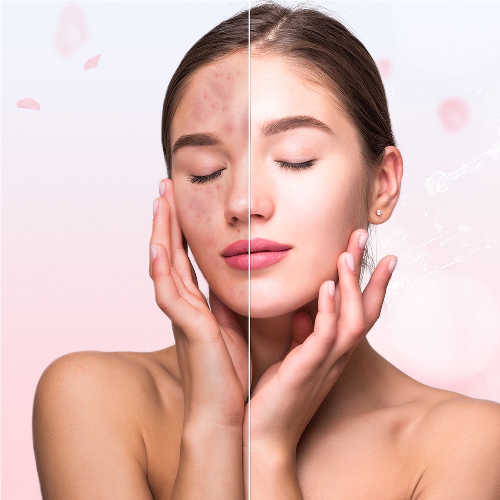 Serum Dưỡng Ẩm Nuôi Dưỡng Làn Da Trắng Hồng BORA HA - B5 Lọ 30ml