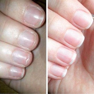 dưỡng móng CND. dưỡng móng, phục hồi móng