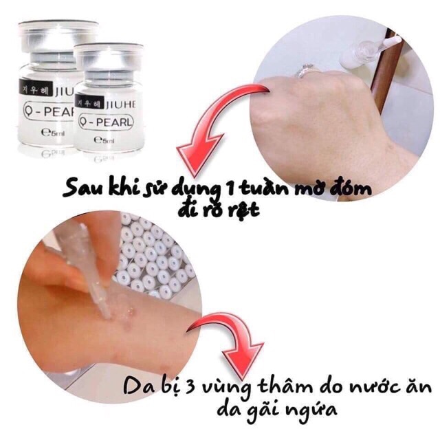 Serum mờ thâm juihe hàng chuẩn