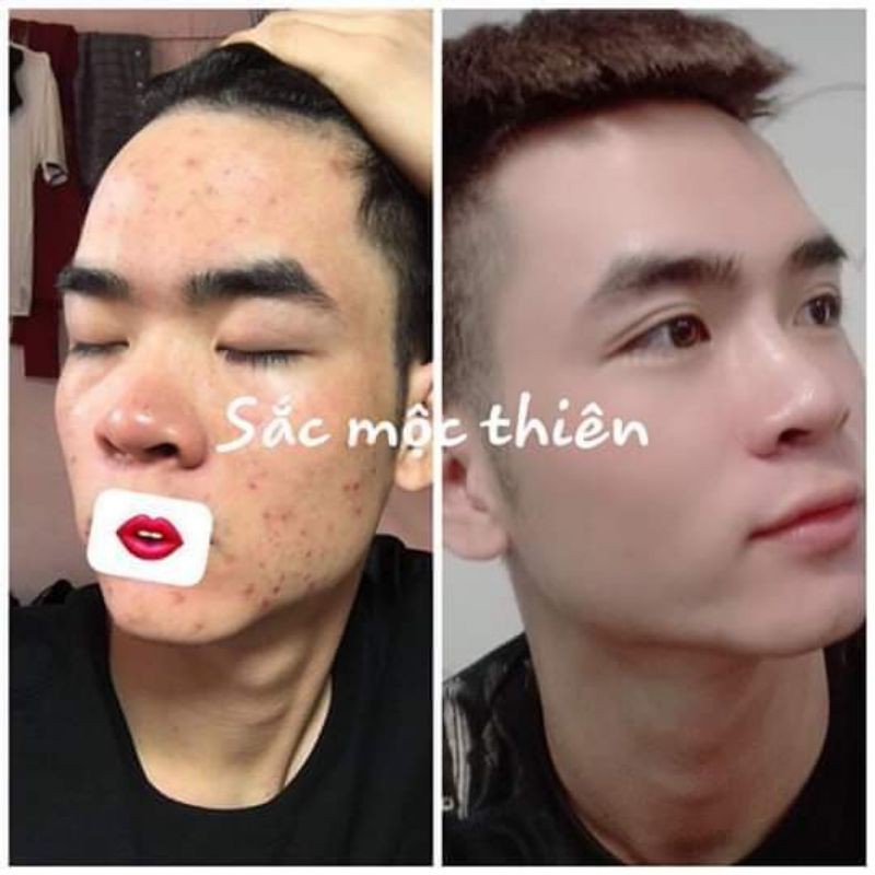 Tinh Chất Tái Tạo Da Siêu Tốc Sắc Mộc Thiên Dành Cho Da Lì