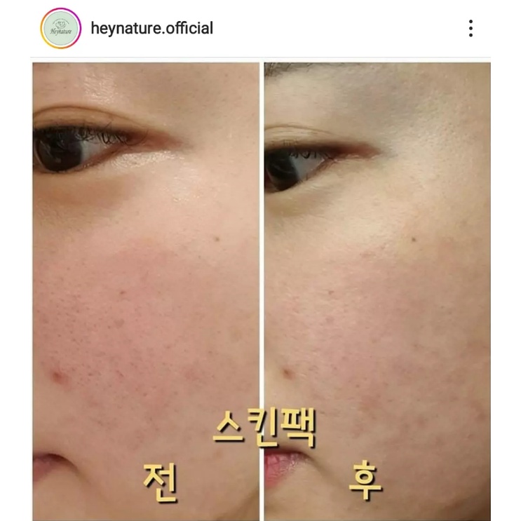 Toner diếp cá dịu da giảm mụn HEYNATURE ERSEONGCHO TONER SKIN CLAM