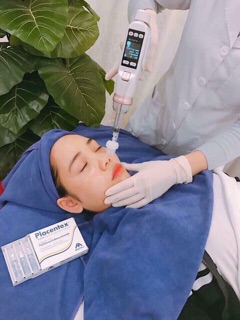 DNA cá hồi Placentex
