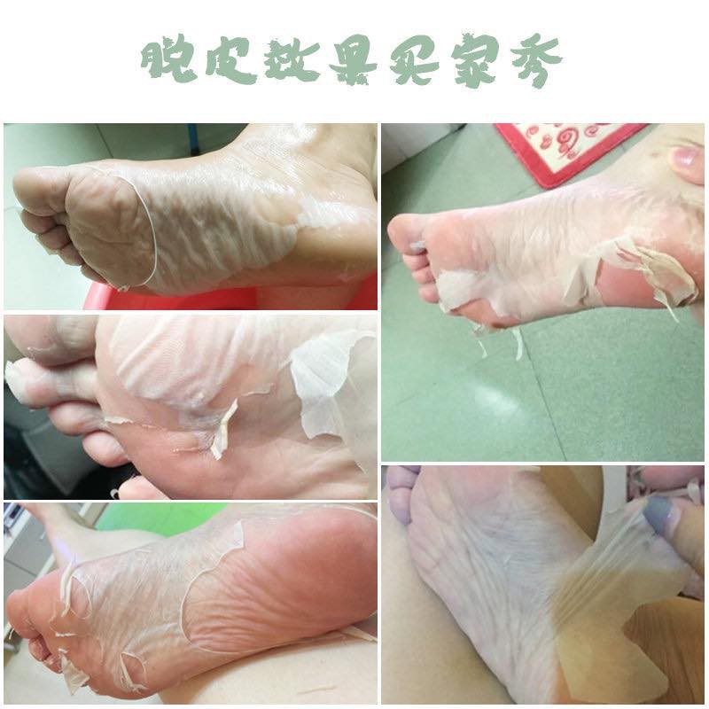 Túi ủ bong da chết bàn chân Mino Baby Foot Nhật Bản