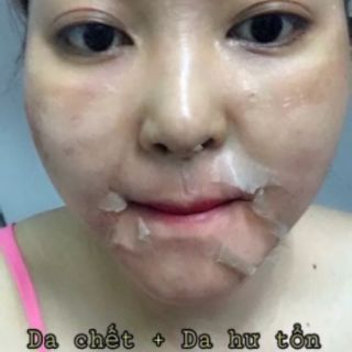 Kem Trắng Da Xóa Nám Sạm Cao Cấp