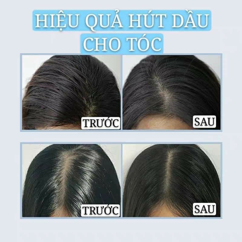 [RẺ VÔ ĐỊCH]ISSY – Dầu gôi khô xịt gội khô không cần nước cho tóc bết dầu