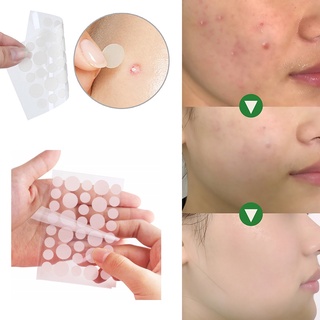 Set 36 Miếng Dán Hỗ trợ giảm mụn Vô Hình Chăm Sóc Da