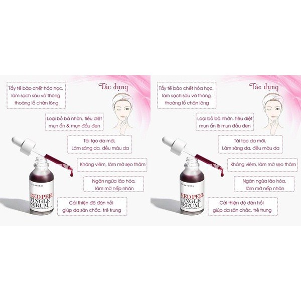 Serum peel da hóa học RED PEEL TINGLE SERUM - PEEL DA KHÔNG BONG TRÓC