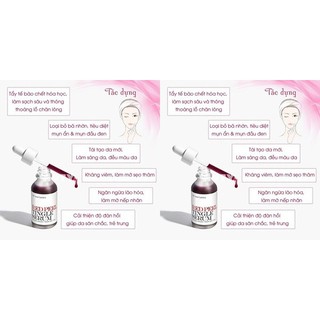 Thay Da Sinh học Red Peel Tingle Serum