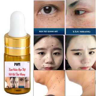 🌺Kem Xóa Nốt Ruồi