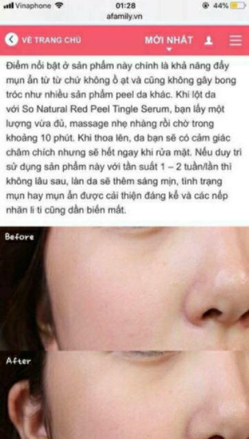 Thay da sinh học Red Peel Tingle Serum -- xuất xứ: Hàn Quốc