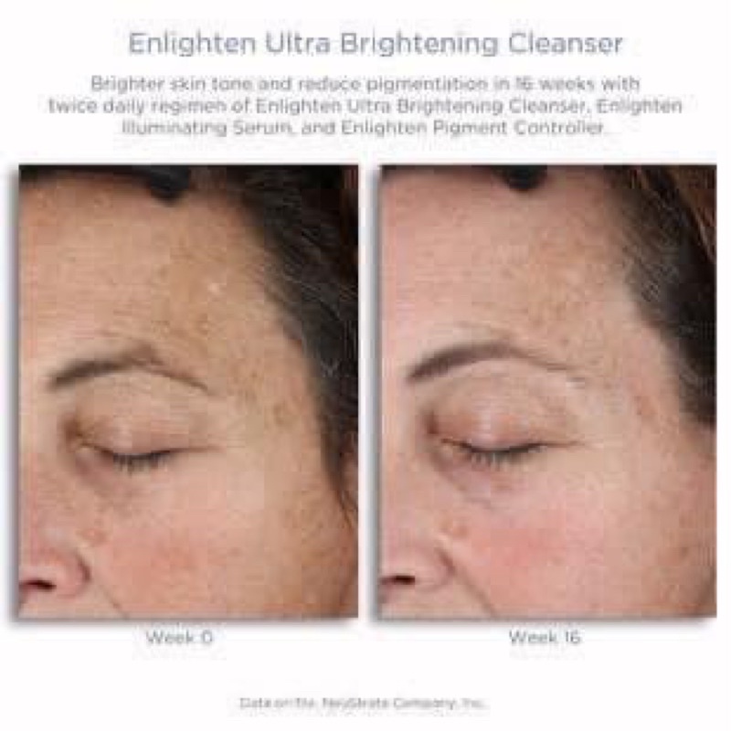 Sữa rửa mặt cho da thâm mụn Neostrata Enlighten Ultra Brightening Cleanse