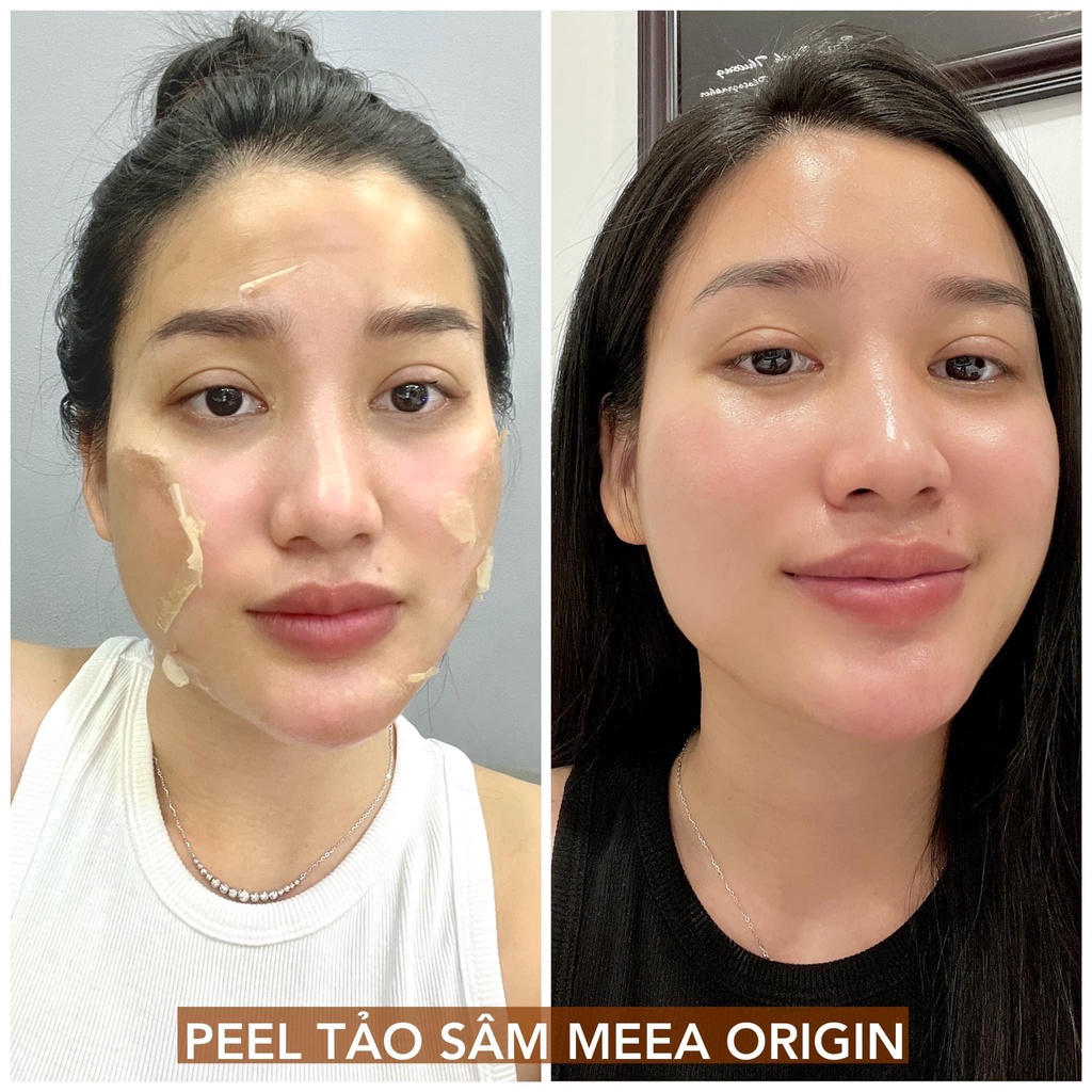 Kem PEEL DA TẢO SÂM 36 VỊ - BÓC TÁCH TẢO SÂM ĐÔNG Y