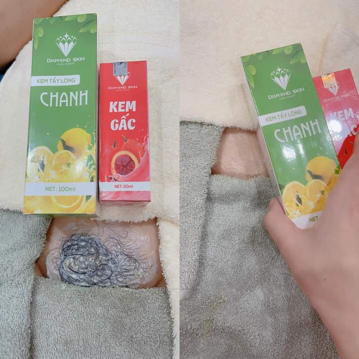 Combo Kem Tẩy Lông Chanh Gấc Triệt Lông Tại Nhà Hiệu Quả Không Mọc Lại | BigBuy360 - bigbuy360.vn