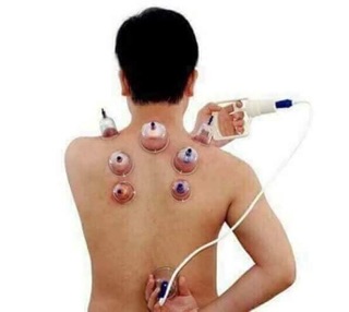 Bộ giác hơi 12 chi tiết