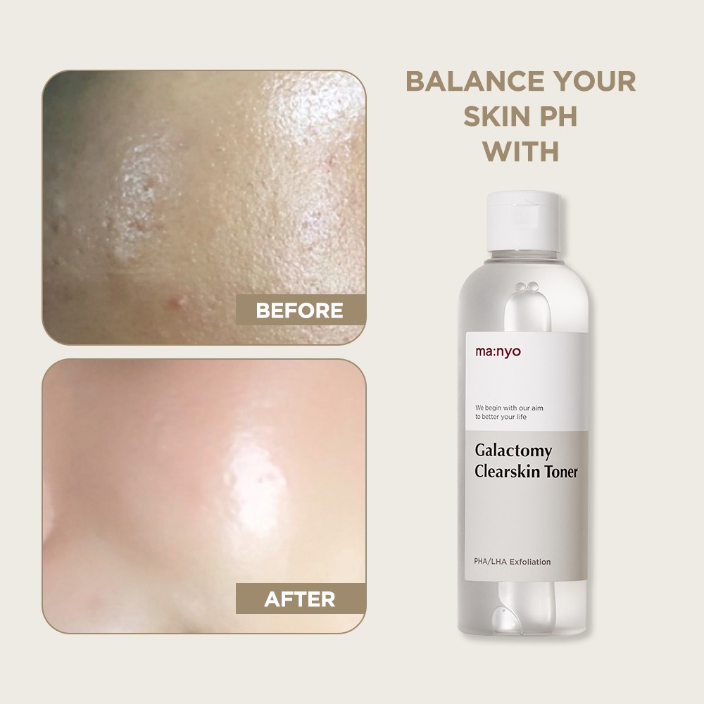 Toner dịch lọc lên men MANYO FACTORY GALACTOMY CLEARSKIN TONER