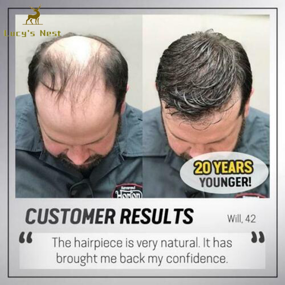 Tóc Giả Ngắn Thẳng Che Phủ Tóc Thưa Cho Nam Giới