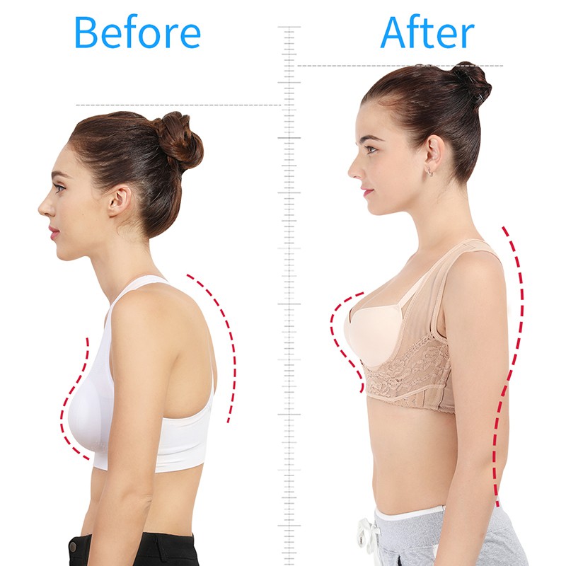 Áo nịt Junlaikang giúp định hình cơ thể và điều chỉnh tư thế cho nữ