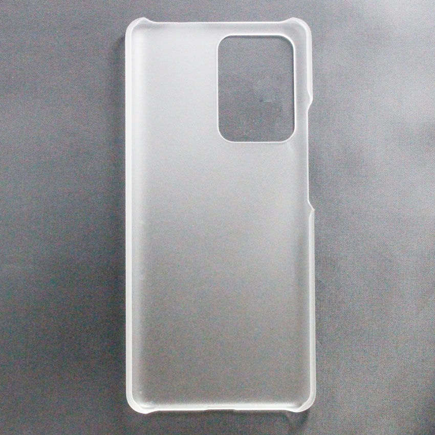 Ốp cứng Remax cho Xiaomi Mi 10i/ 10T Lite/ 10s/ 11/ 11 Lite/ 11 Lite 5G NE/ 11 Pro/ 11T/ 11T Pro/11 Ultra/11X Pro/ Mix 4