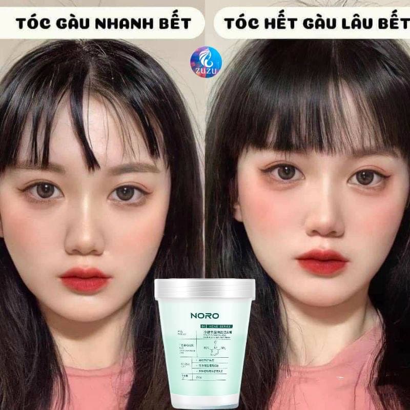 Tẩy Da Chết Da Đầu Nicor Kiểm Soát Dầu Nhờn Giảm Bết Tóc Zuzu Cosmetic